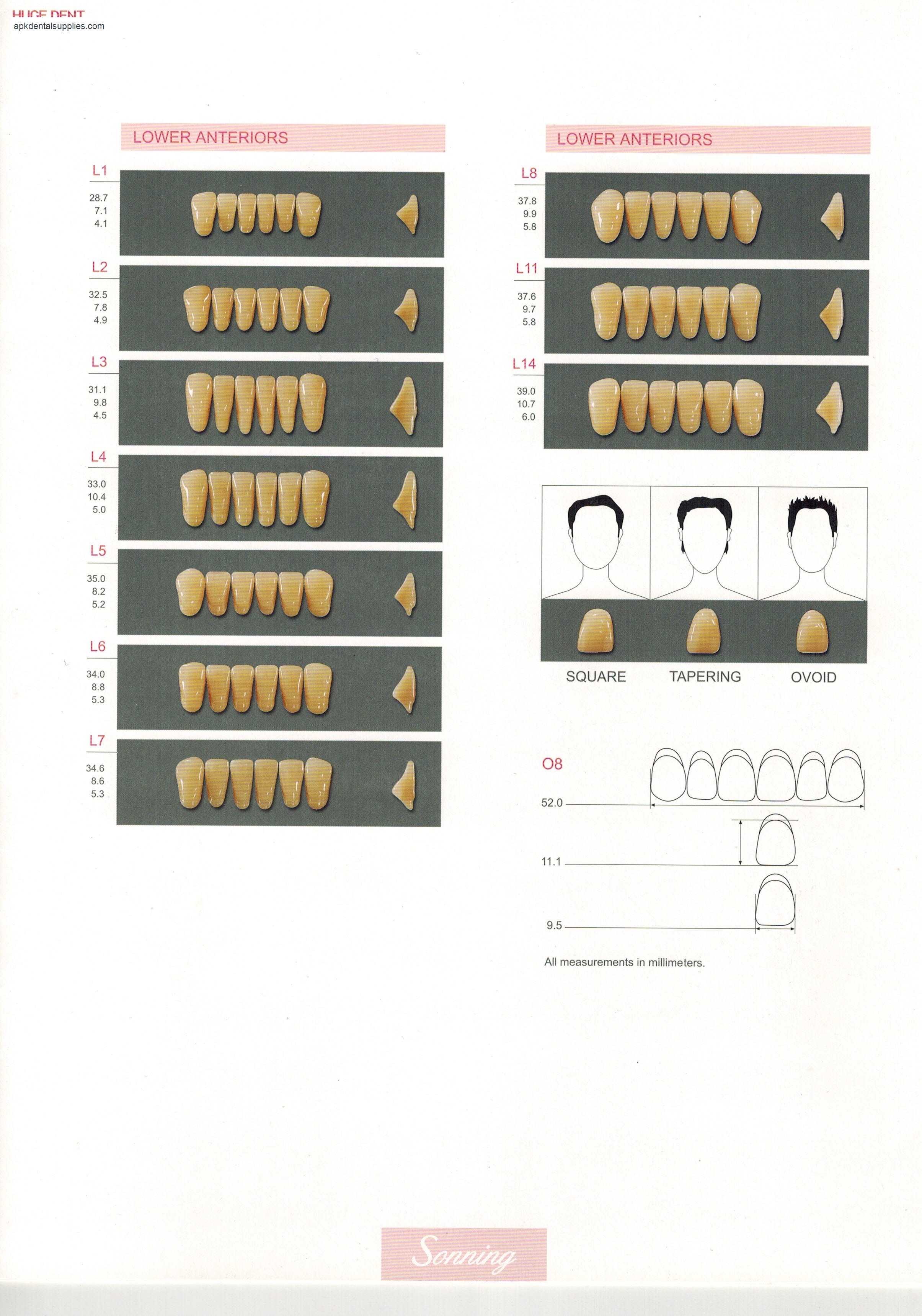 Sonning lower anterior moulds